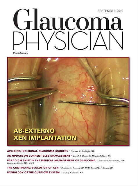 Glaucoma Physician